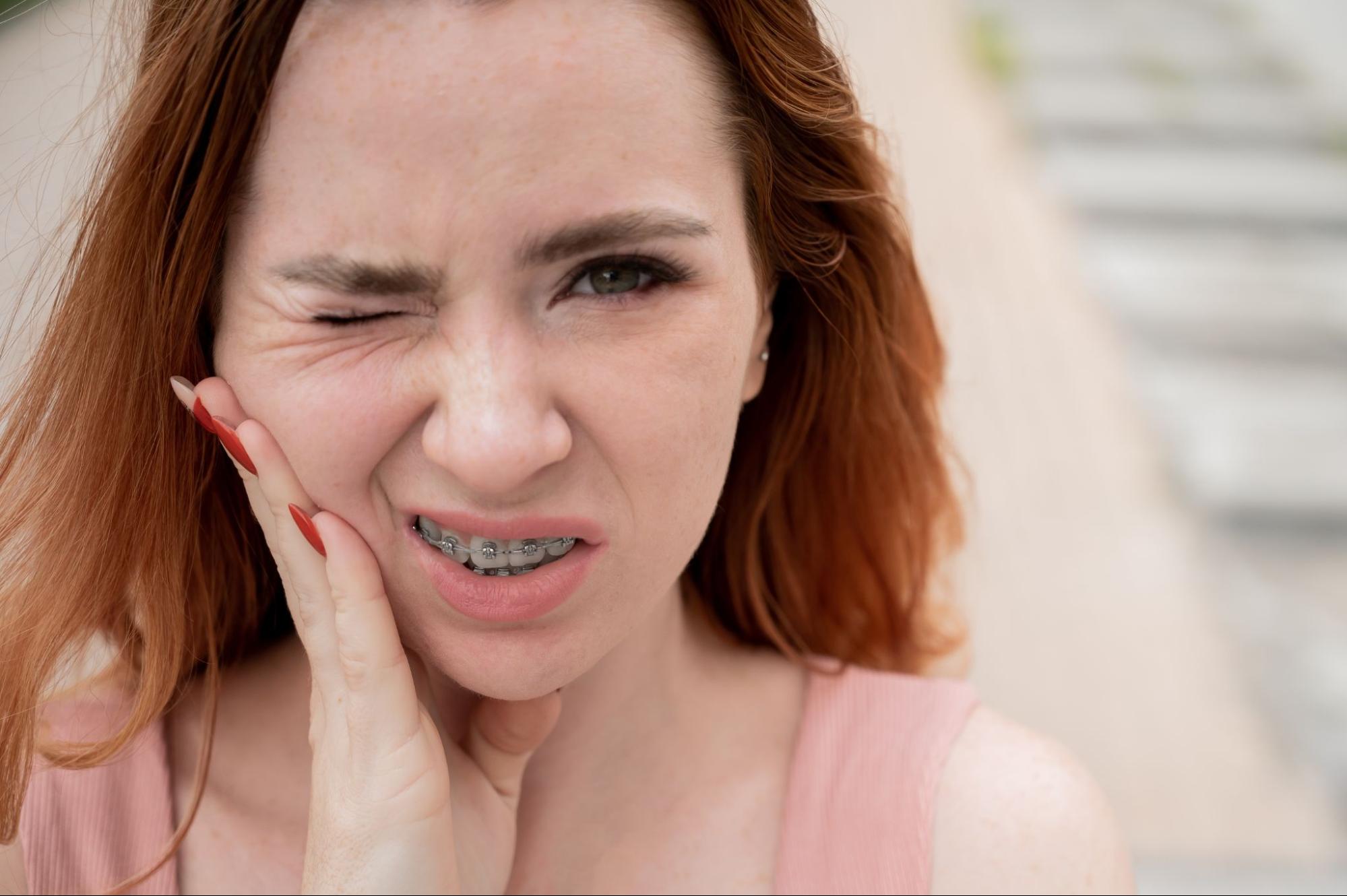 Young woman with braces wincing in discomfort, holding her cheek, illustrating common soreness experienced during orthodontic treatment; relevant to tips for managing discomfort with clear aligners and braces from Viva Orthodontics.