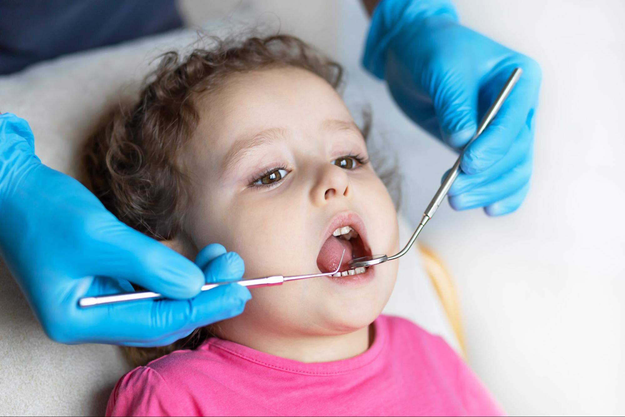 Child receiving dental check-up with orthodontic tools, emphasizing oral hygiene for braces and clear aligners at Viva Orthodontics in Bountiful.