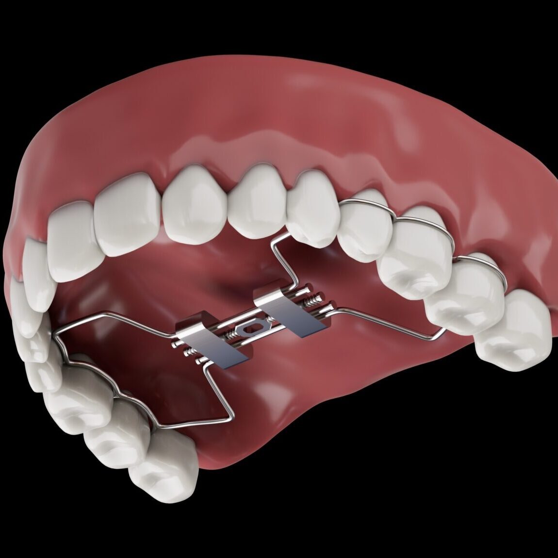 bountiful-orthodontist-001 bountiful orthodontist
