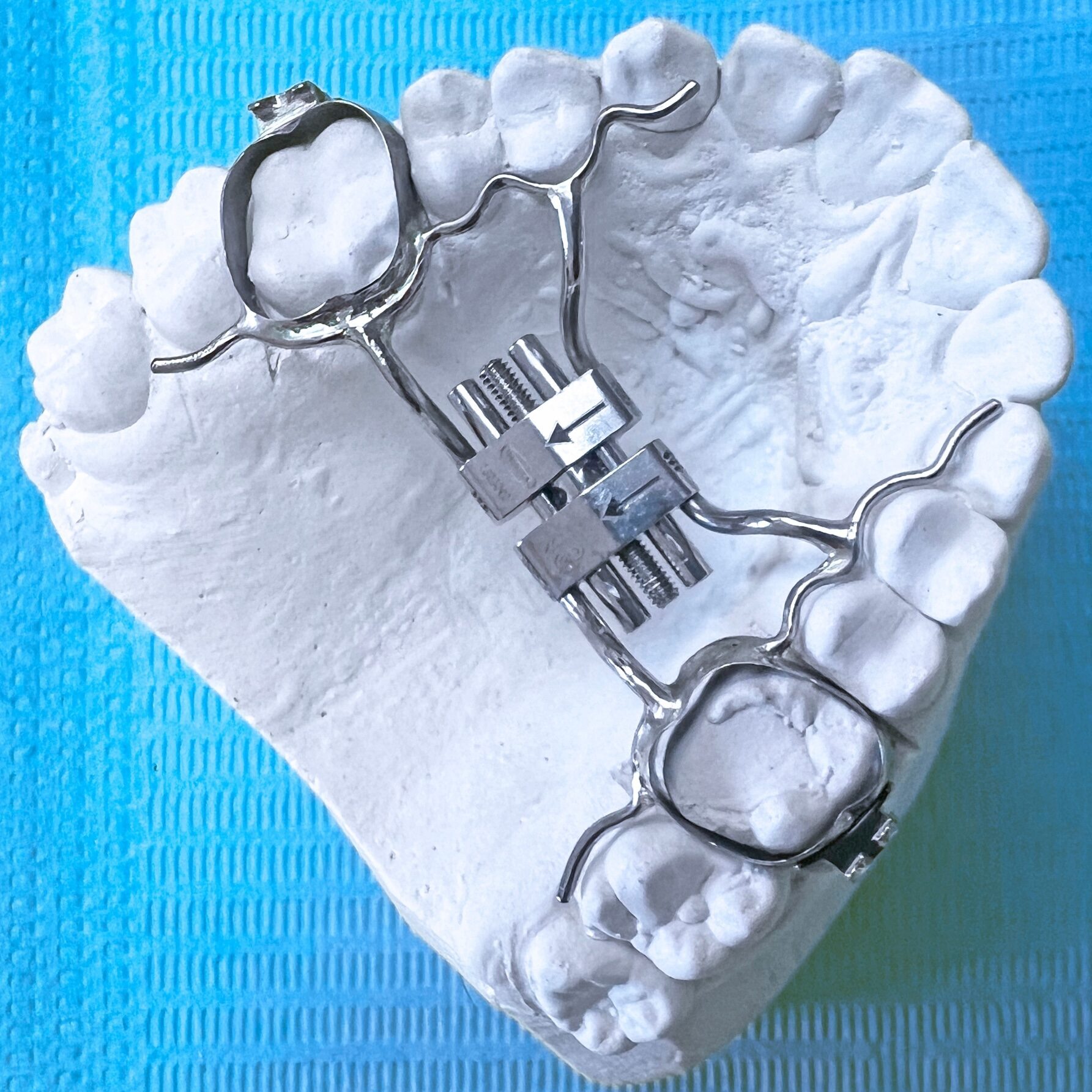 orthodontist-bountiful-ut-001 orthodontist bountiful ut